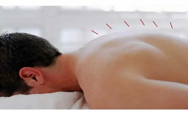 Complicações das veias varicosas das extremidades inferiores
